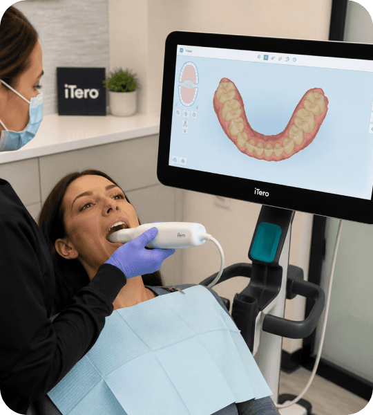 itero scanner