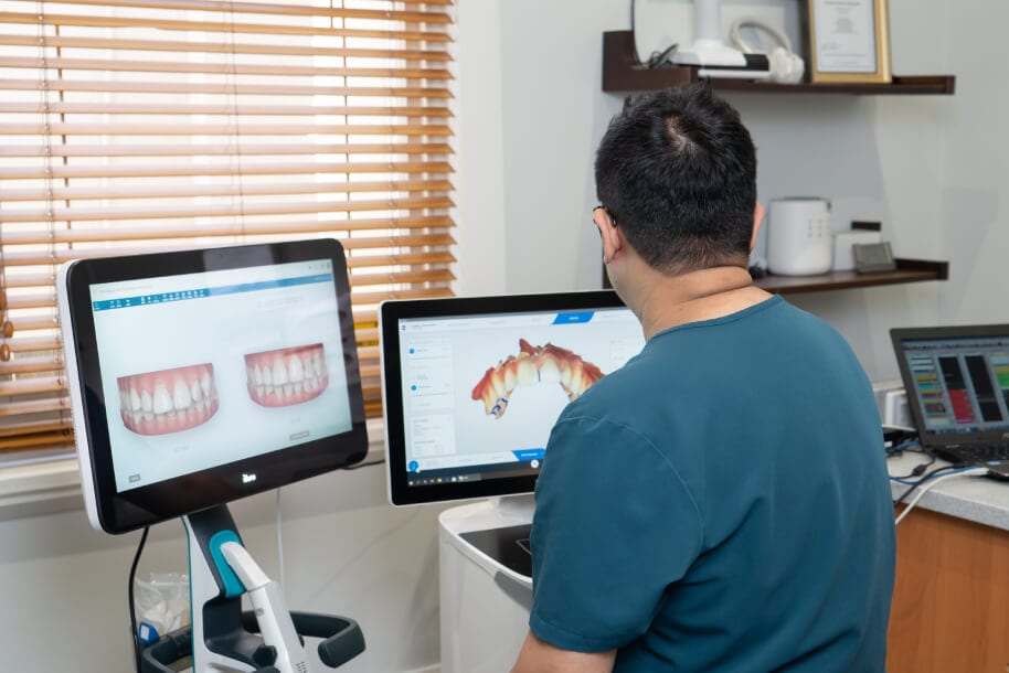 Digital dental scan